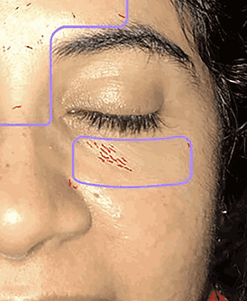 Advanced AI Skin Analysis