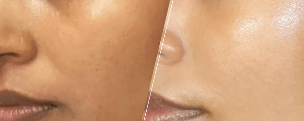 Before and after image of face skin